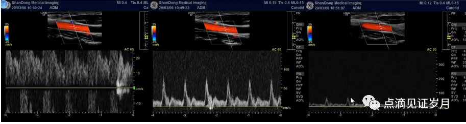 Understanding and Adjusting Parameters of Color Doppler Ultrasound Machines