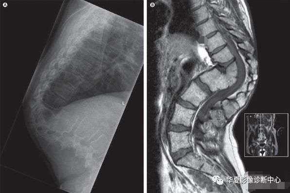 Understanding Medical 3D Printing and Its Applications