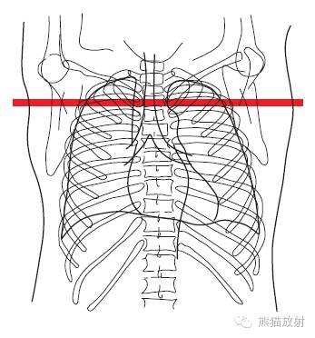 Chest Anatomy | Chest CT Cross-Sectional Anatomy