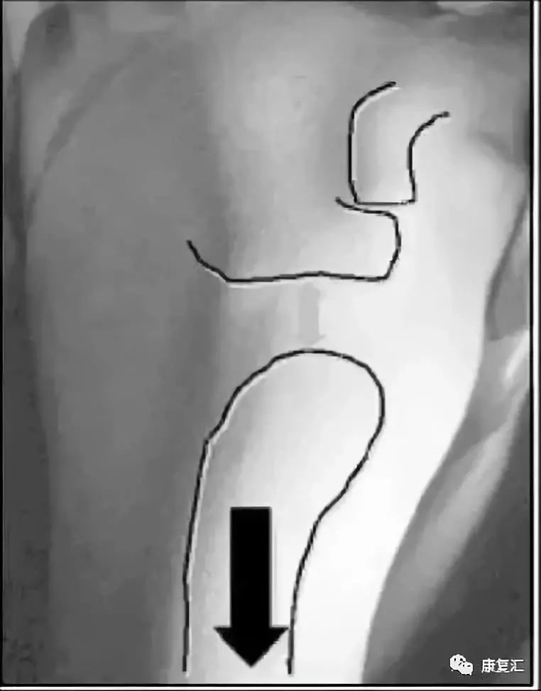 Detailed Guide to Shoulder Joint Physical Examination for Rehabilitation