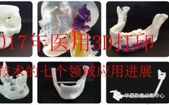 Understanding Medical 3D Printing and Its Applications