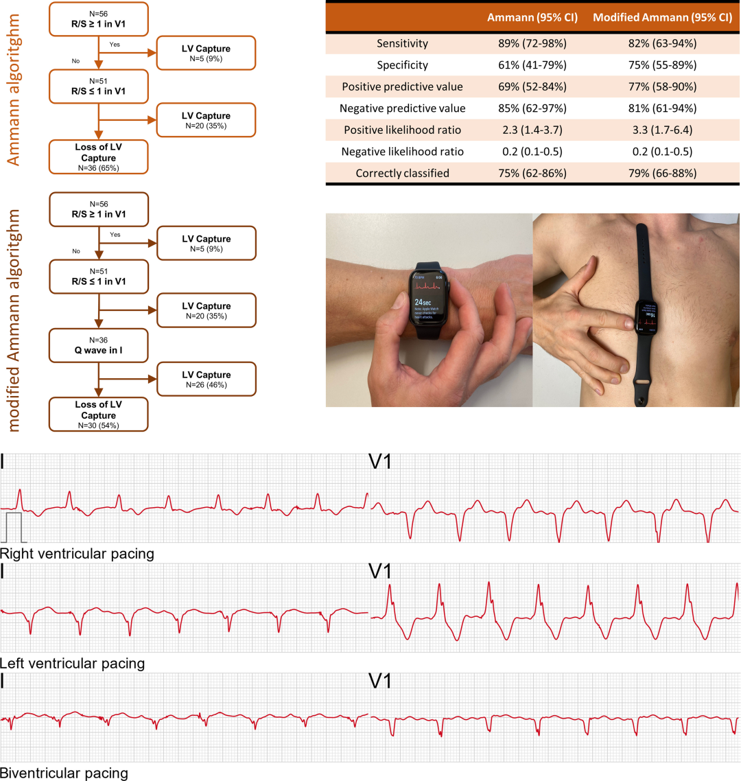 Mastering Smartwatches: Transforming Into An ECG Machine