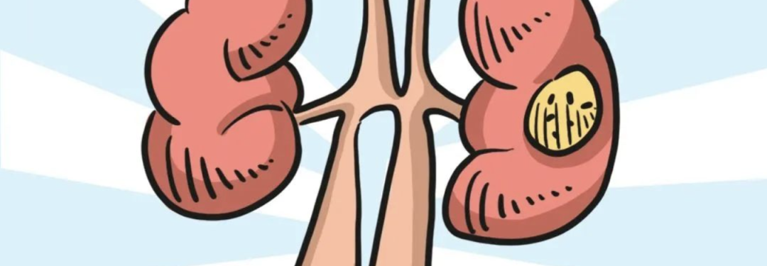 DIY Gout Treatment: Doctor Explains Patient Mistakes