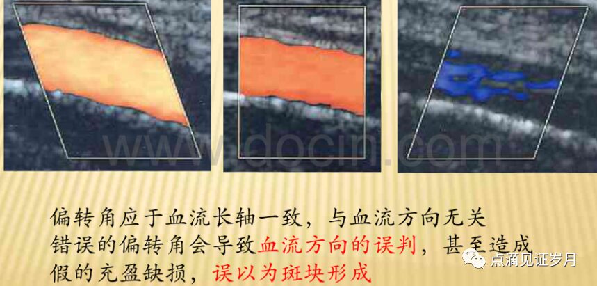 Understanding and Adjusting Parameters of Color Doppler Ultrasound Machines