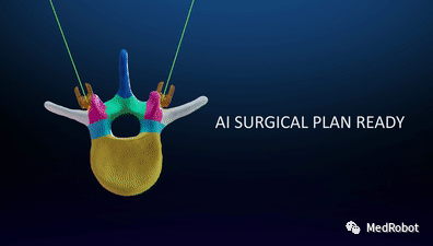 Overview of 5 Orthopedic Navigation and Surgical Robots