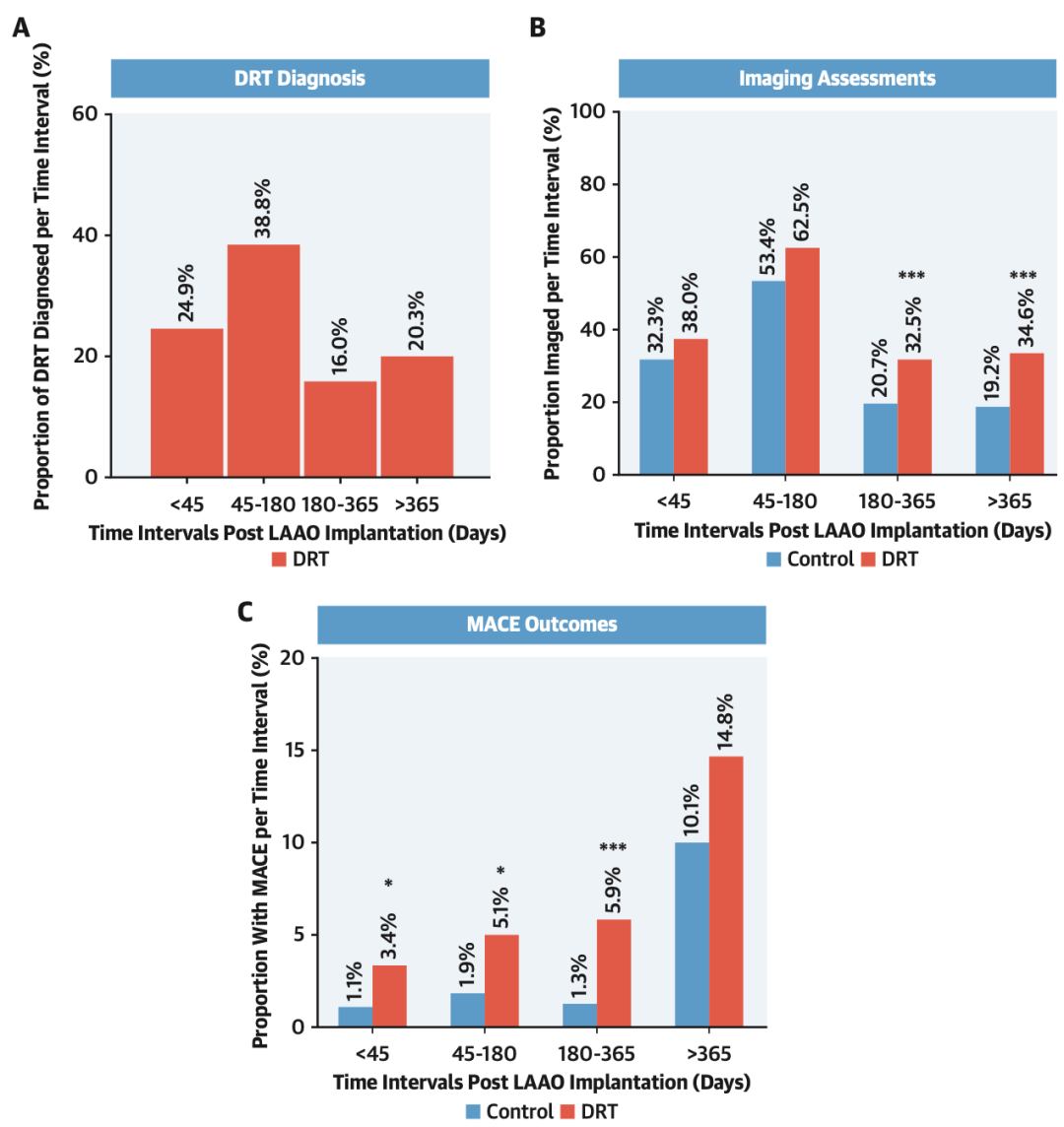 Predictive Factors of DRT After LAAO: International Multicenter Data