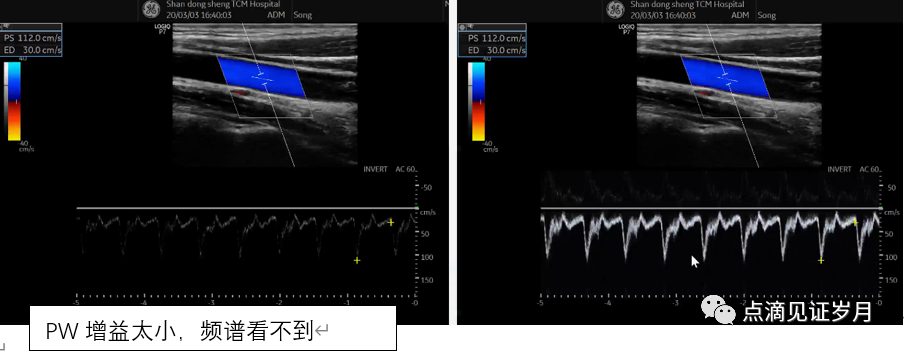 Understanding and Adjusting Parameters of Color Doppler Ultrasound Machines