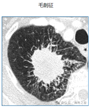 Compilation of Chest Imaging Terminology (IV)