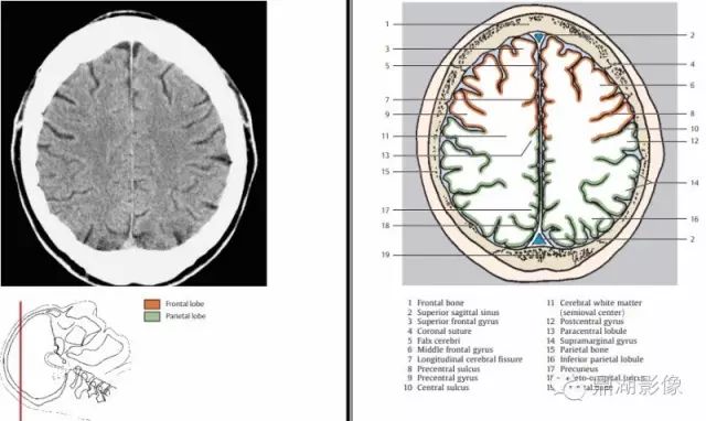 The Most Comprehensive CT Cross-Sectional Anatomy Atlas