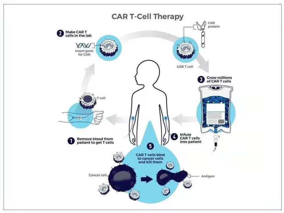 Phase I Clinical Trial of New CoupidCAR Therapy GCC19CART for Refractory Solid Tumors