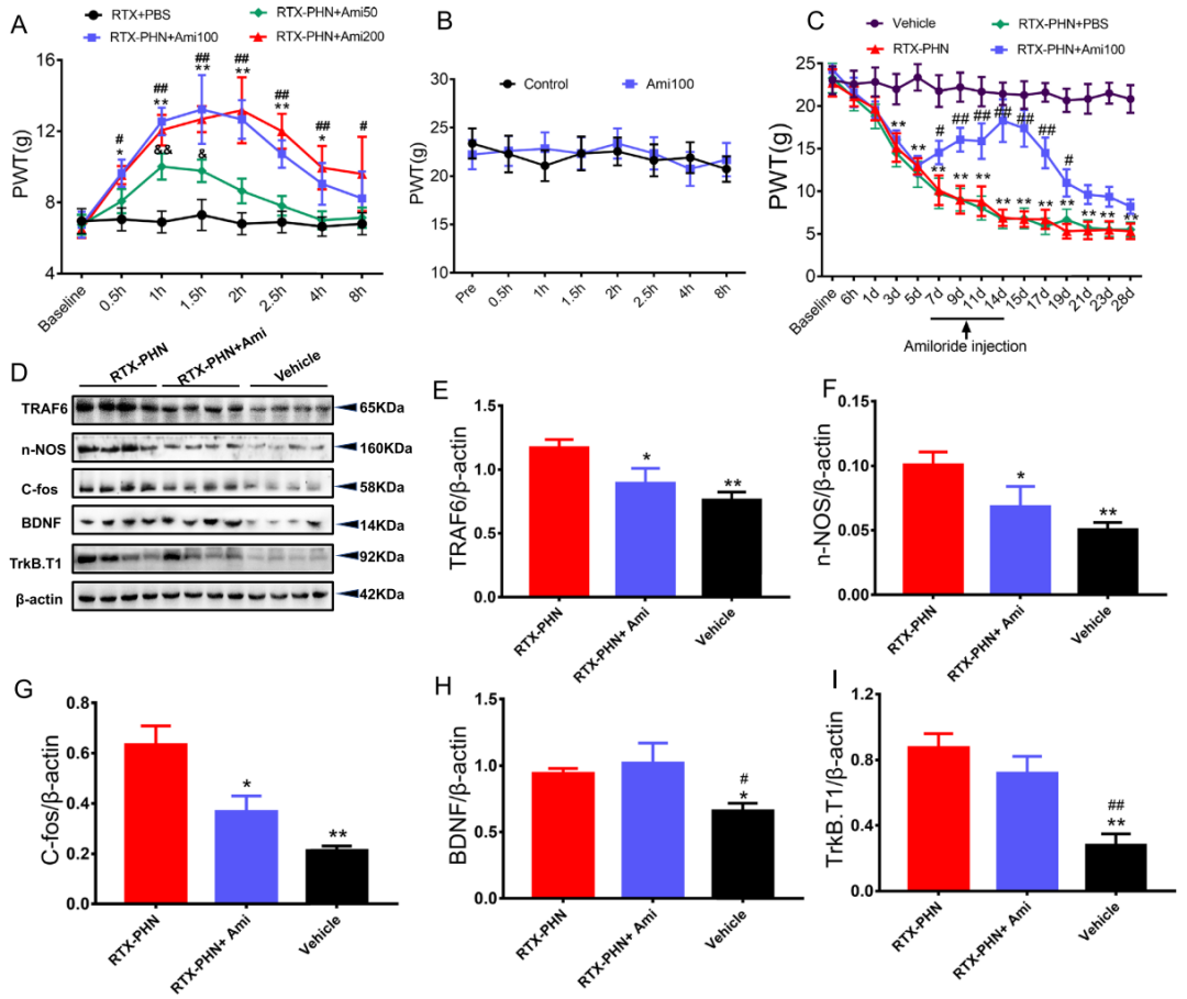 Inhibiting BDNF/TrkB.T1 Receptor Alleviates Postherpetic Neuralgia