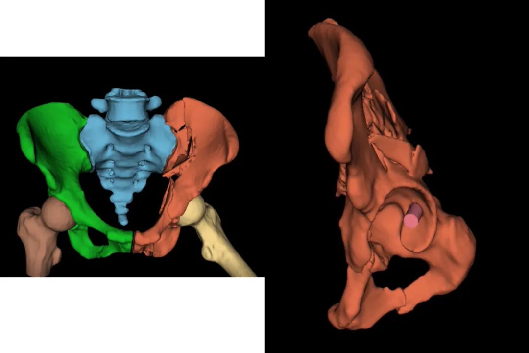 3D Printing Bones: Turning Virtual into Reality