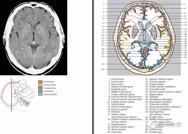 The Most Comprehensive CT Cross-Sectional Anatomy Atlas