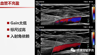 Understanding and Adjusting Parameters of Color Doppler Ultrasound Machines