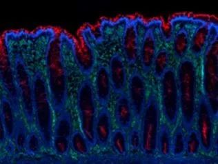Understanding IF, ICC, and IHC Techniques
