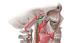 Mastering Clinical Treatment of Internal Carotid Artery Occlusion (ICAO)