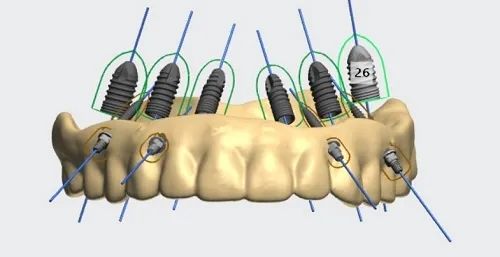 Revealing the Secrets of 3D Printing Technology in Dentistry