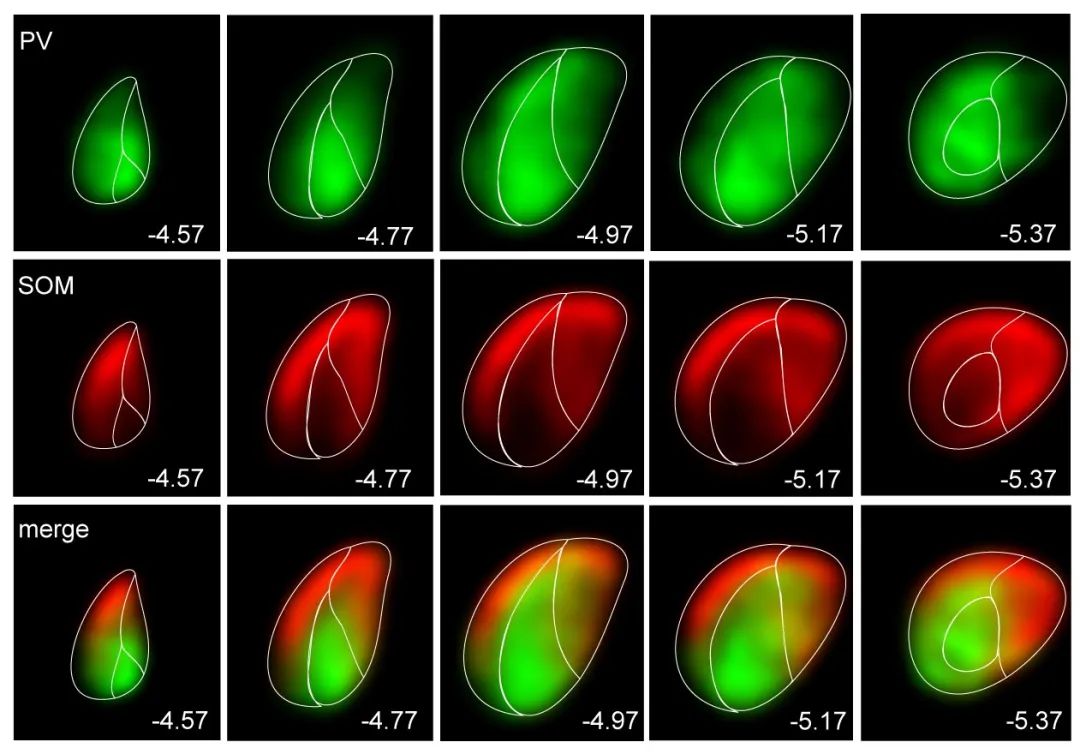 Challenging Traditional Views: Tsinghua Team Redefines Auditory Pathways