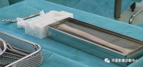 Understanding Medical 3D Printing and Its Applications