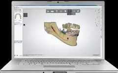 Revealing the Secrets of 3D Printing Technology in Dentistry