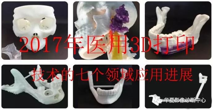 Understanding Medical 3D Printing and Its Applications