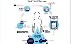 Phase I Clinical Trial of New CoupidCAR Therapy GCC19CART for Refractory Solid Tumors