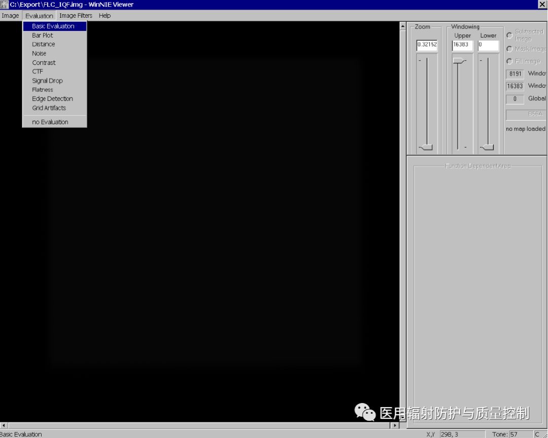 Siemens DR Preprocessing Image Retrieval (Part 1)