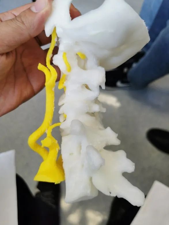 3D Printing Bones: Turning Virtual into Reality