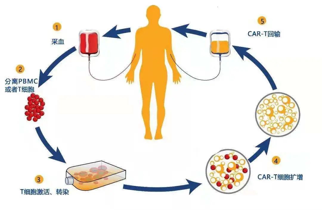 Phase I Clinical Trial of New CoupidCAR Therapy GCC19CART for Refractory Solid Tumors