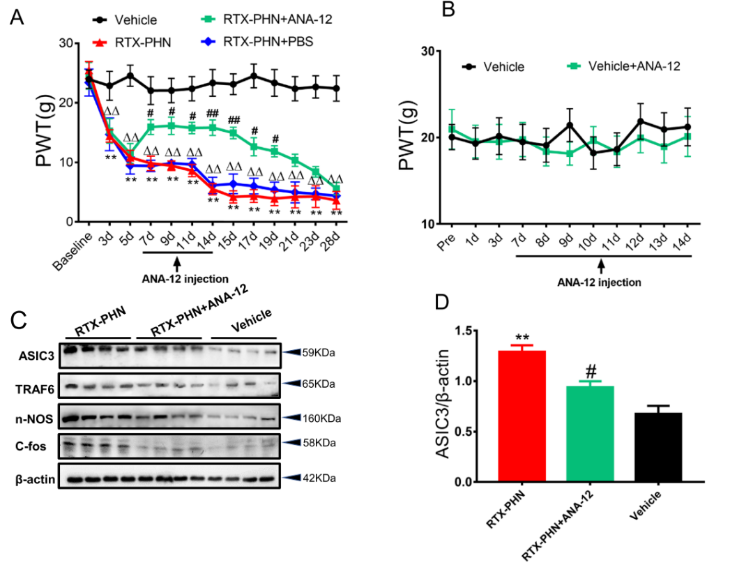 Inhibiting BDNF/TrkB.T1 Receptor Alleviates Postherpetic Neuralgia