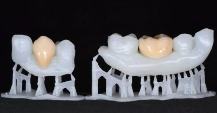 Overview: Eight Major Applications of 3D Printing in Dentistry
