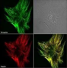 Understanding IF, ICC, and IHC Techniques