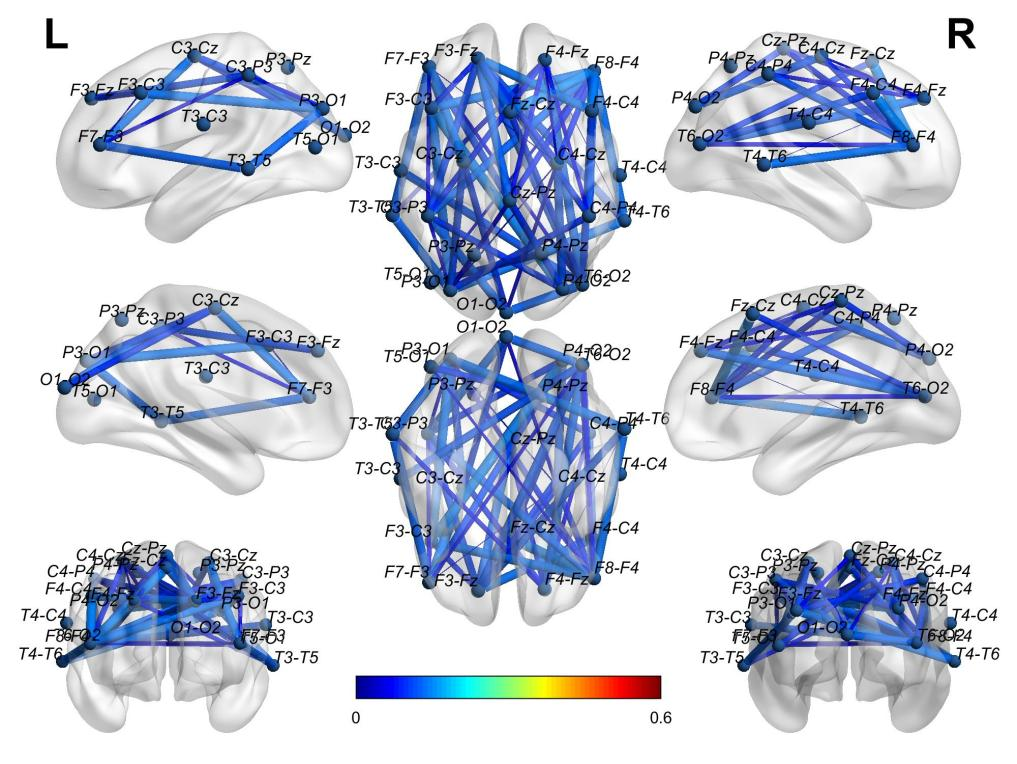 HBM: Spatial-Temporal Graph Convolutional Networks for Alzheimer's Diagnosis Using Brain Functional Connectivity