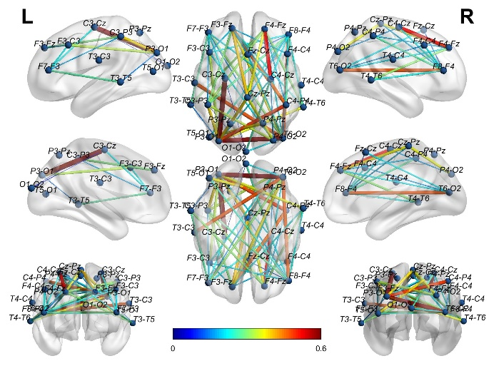 HBM: Spatial-Temporal Graph Convolutional Networks for Alzheimer's Diagnosis Using Brain Functional Connectivity