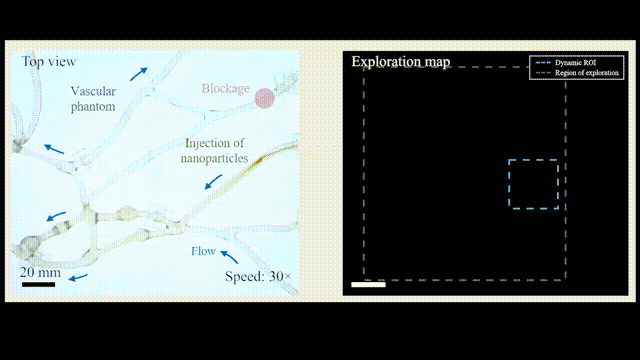 Professor Yu Jiangfan from CUHK (Shenzhen): Intelligent Micro-Robots Driven by AI Leading Innovations in Minimally Invasive Precision Medicine
