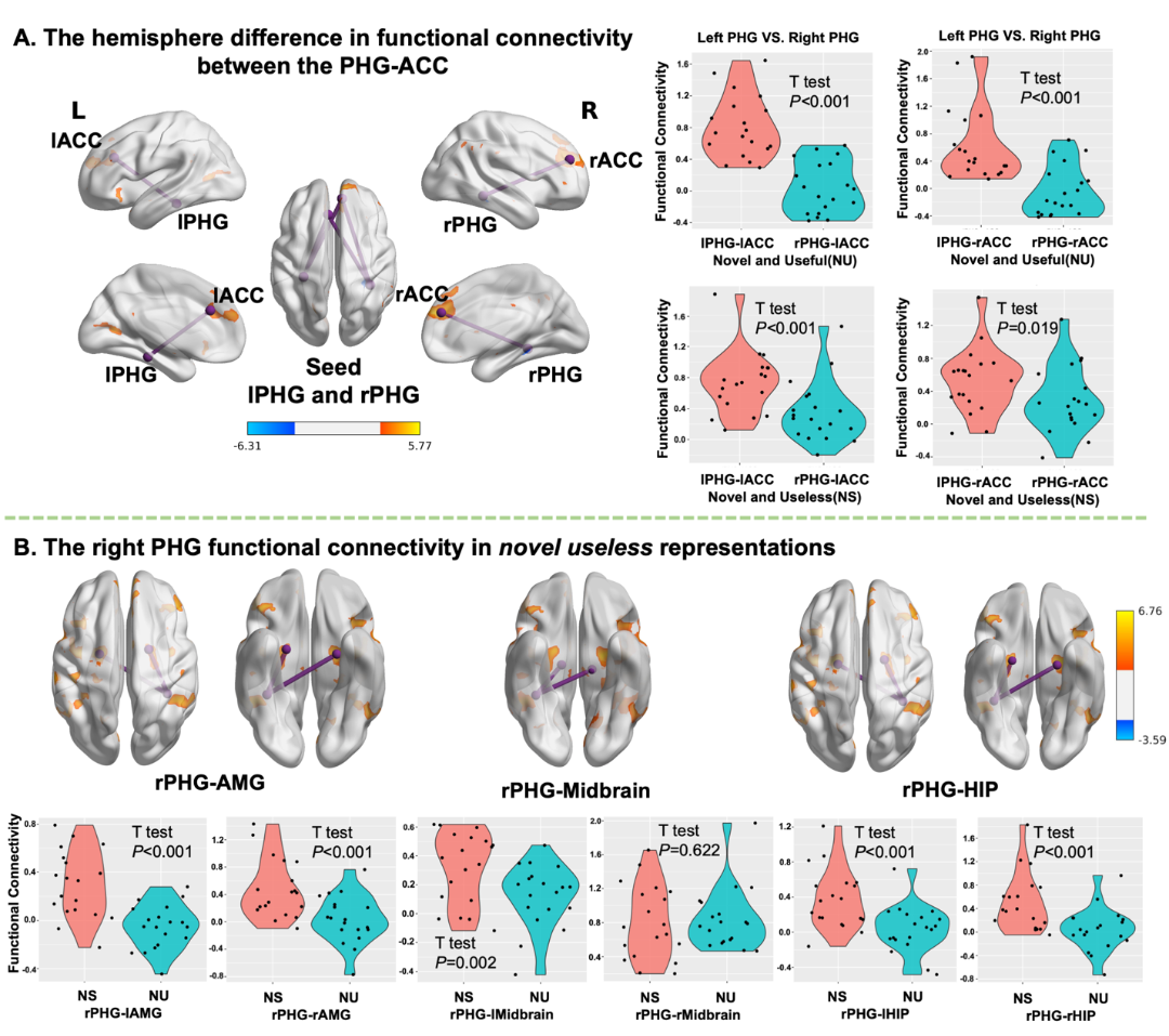 Cereb Cortex | Left Brain vs Right Brain: Mechanisms of Functional Lateralization in the Medial Temporal Lobe During Creative Evaluation