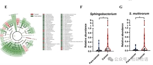 Literature Sharing | S. multivorum in Tumors Promotes Progression of Triple-Negative Breast Cancer by Suppressing Tumor Immuno-surveillance