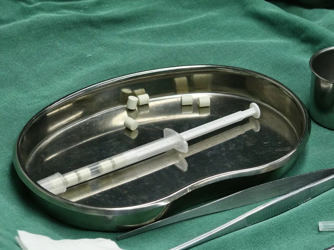 First Case in Anhui! Today, a Fuyang Man Receives Alcoholism 'Chip' Implant, Post-Operative Experience Revealed!