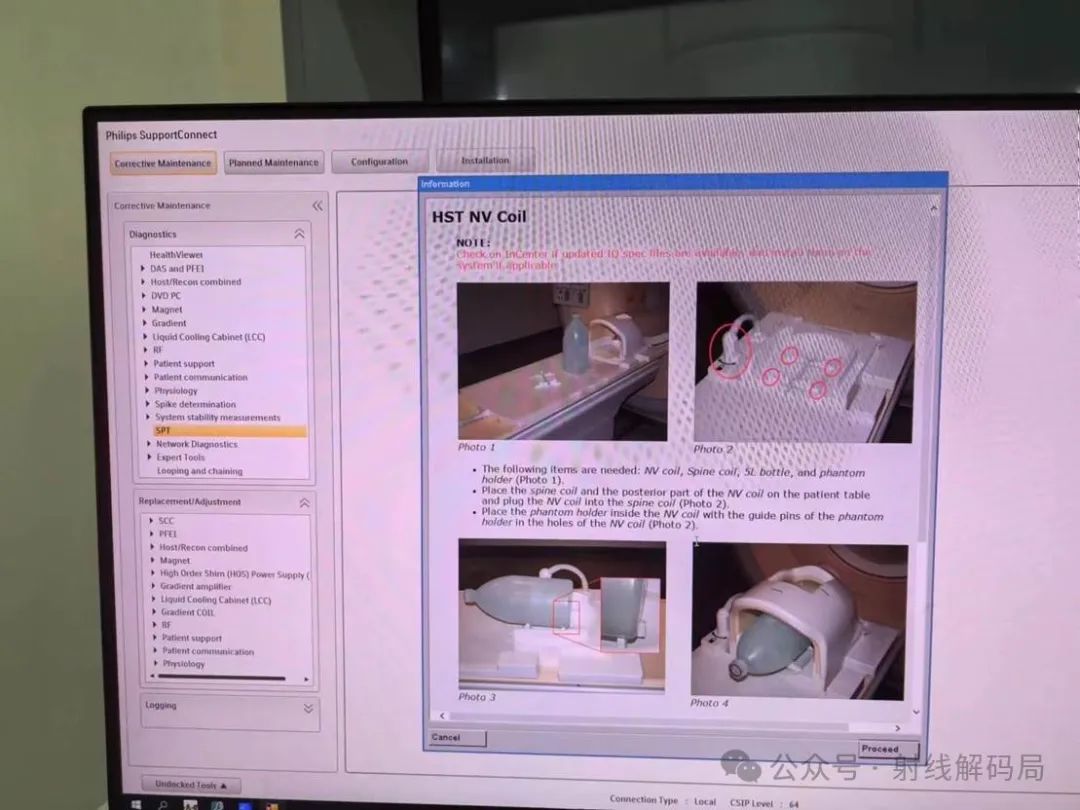 Philips MRI Multive 1.5T Coil Channel Selection and Testing
