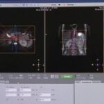 Philips Multiva 1.5T MR Operation Video (Part 5)