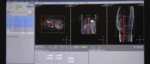 Philips Multiva 1.5T MR Operation Video (Part 5)