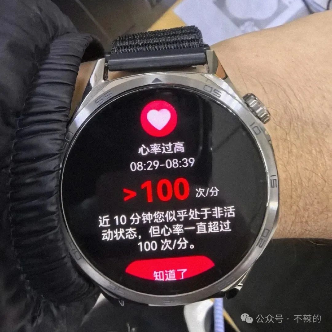 Health Guardians on Your Wrist: How Smartwatches Revolutionize Health Monitoring