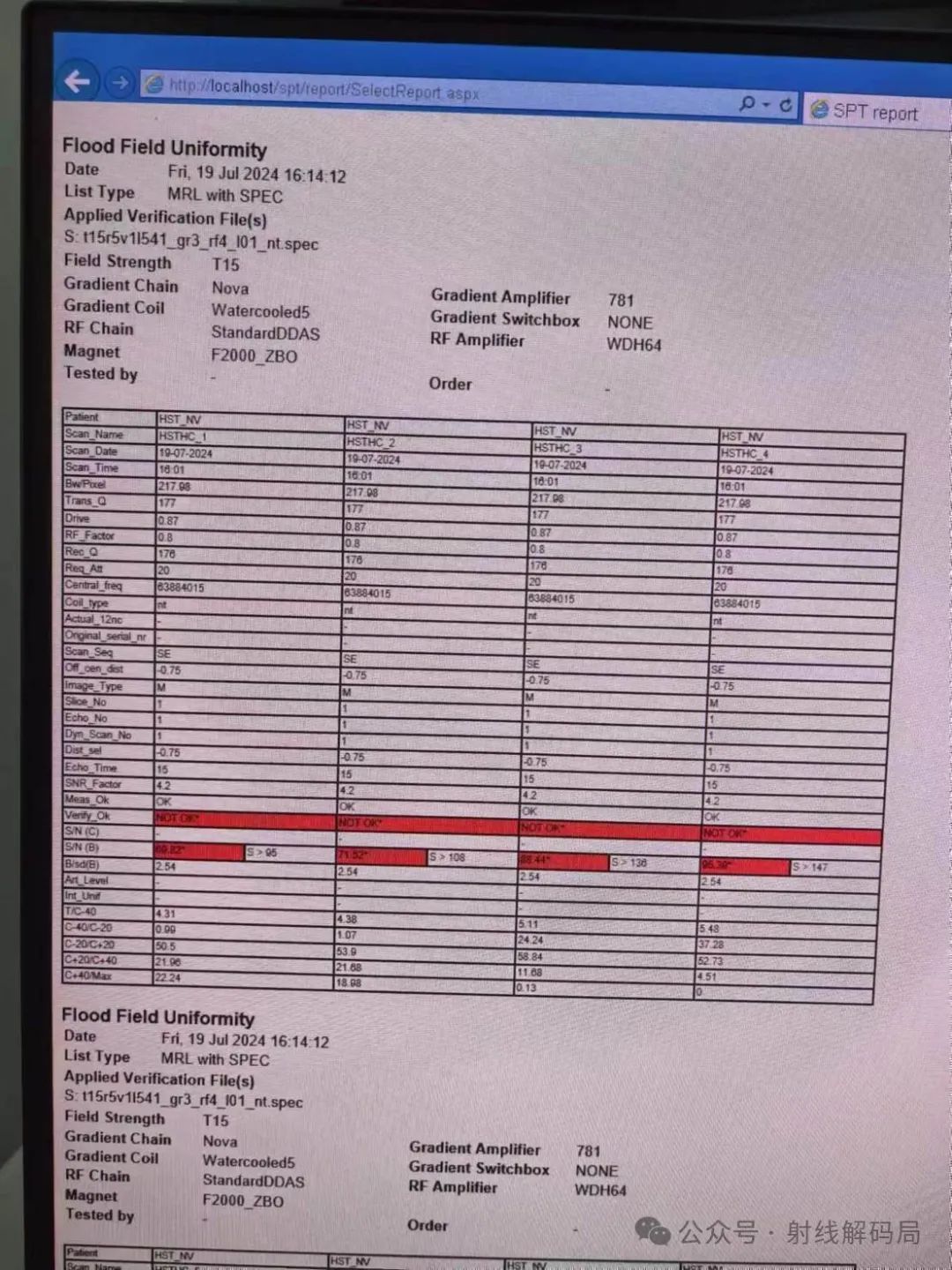 Philips MRI Multive 1.5T Coil Channel Selection and Testing