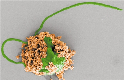 News: Smart Micro Robots with Electronic 'Brains' Walk Autonomously; Micro Swimming Robots May Treat Deadly Pneumonia; US Company Modifies Drones for Medical Supply Drops in Ukraine