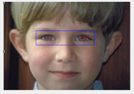 How to Detect Human Eyes with MATLAB? Use This Function for Object Detection