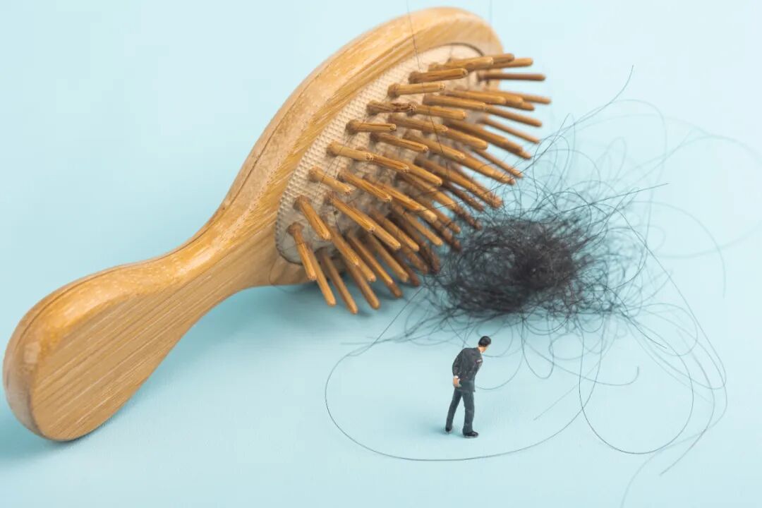 Hair Loss Has Hope! 3D Printing Expected to Supply Hair Follicles in Unlimited Quantities