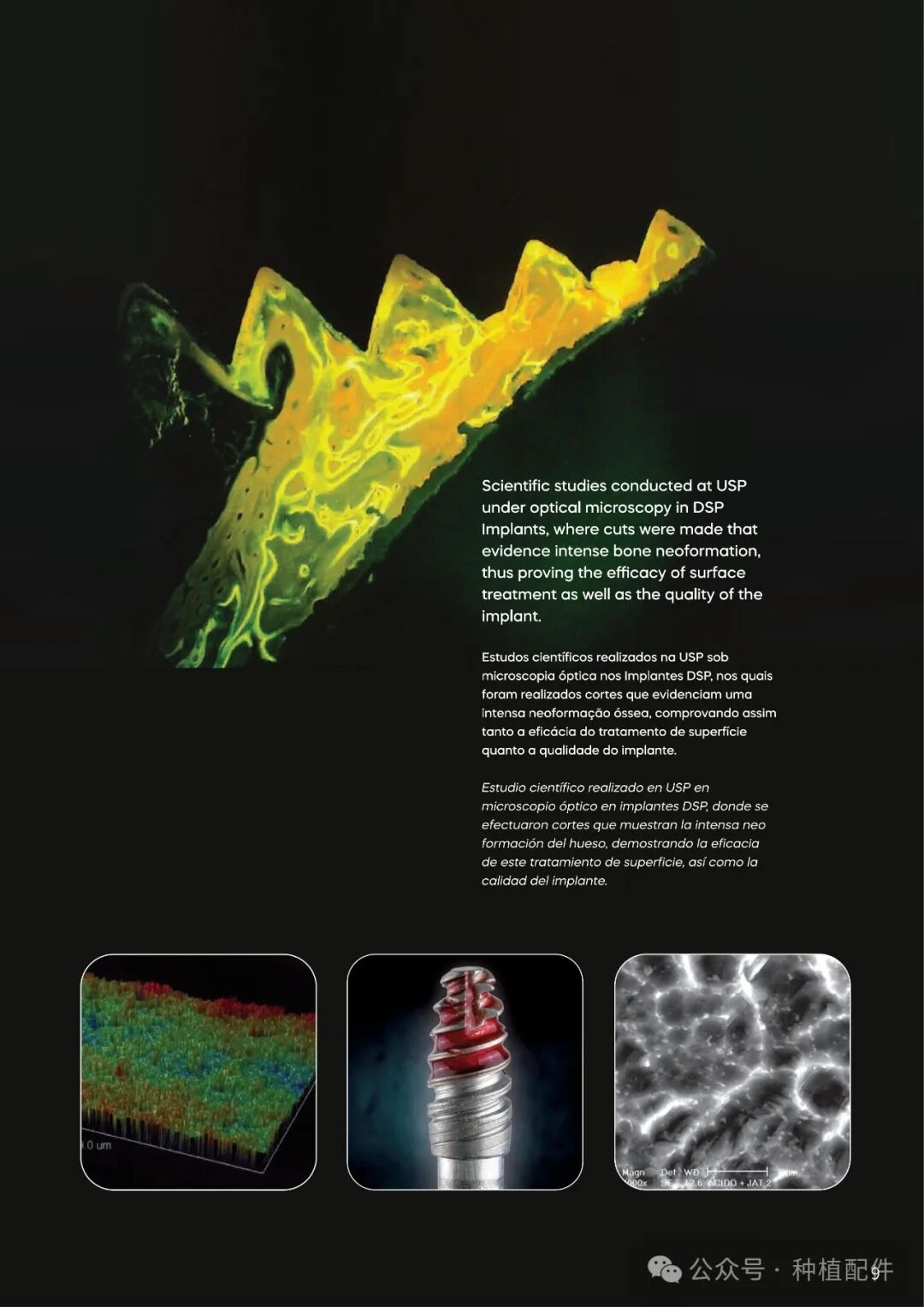 DSP Implant Manual: Chuan Qian - Short, Slim, Biofit, Soulfit, Propfit, Wayfit, HIM, HIL
