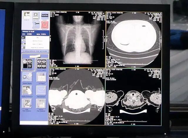 What Cutting-Edge Technologies Do AI Service Robots on the Frontline of Epidemic Prevention Have?