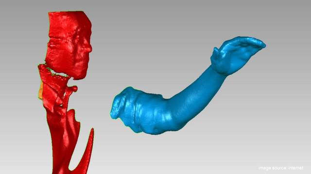 Can 3D Printing Really Create Organs? At Least It Helped a Bird!