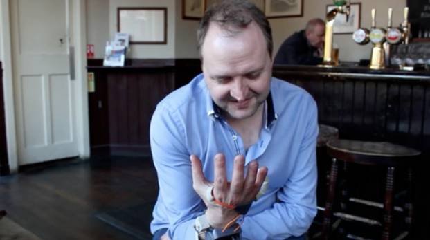 Incredible! 3D Printing a Finger to Transform Ordinary People into Six-Fingered Musicians!?
